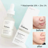 "The Ordinary Niacinamide 10% + Zinc 1% (30ml) with Batch Code"