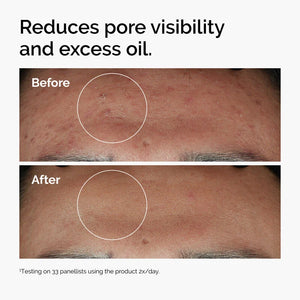 Niacinamide 10% + Zinc 1% (Imported Serum)